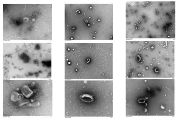 细胞外泌囊泡外泌体粒径检测电镜检测